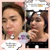 Kem mụn Acne Mỹ Lyn chính hãng - Giảm mụn nhanh, kèm hướng dẫn và túi đựng, 62.900đ 5