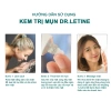 Kem Mụn Dr.Letine Gel Giảm Mụn Trứng Cá - Ngừa Thâm, Mờ Sẹo, Da Dầu, Da Sáng Mịn, Giá ưu đãi 169.000 VND 2