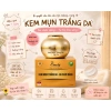 Kem mụn OMELY 30g - Trắng da đa chức năng, chăm sóc da VIP, giảm còn 386.000đ 2