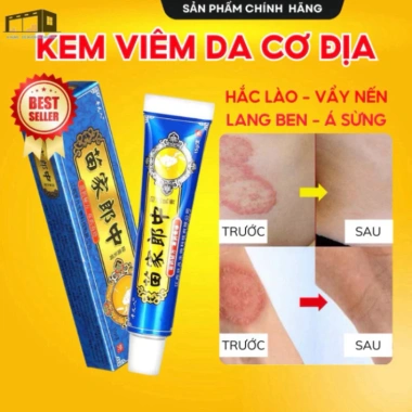 Kem Nấm Nhật - Dứt Điểm Nấm, Ngứa, Hắc Lào, Tổ Đỉa, Cực Hiệu Quả 24k Kem Nấm Nhật - Dứt Điểm Nấm, Ngứa, Hắc Lào, Tổ Đỉa, Cực Hiệu Quả 24k
