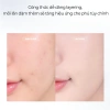 Kem Nền ABOUT TONE Skin Layer Fit Foundation Mỏng Nhẹ Tự Nhiên Che Phủ Tốt Lâu Trôi 30ml - 235k 3