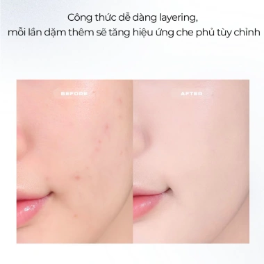 Kem Nền ABOUT TONE Skin Layer Fit Foundation Mỏng Nhẹ Tự Nhiên Che Phủ Tốt Lâu Trôi 30ml - 235k 3