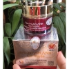Kem Ngăn Anh Gia Truyền 30g Trị mụn thâm trắng da giảm còn 92.400đ