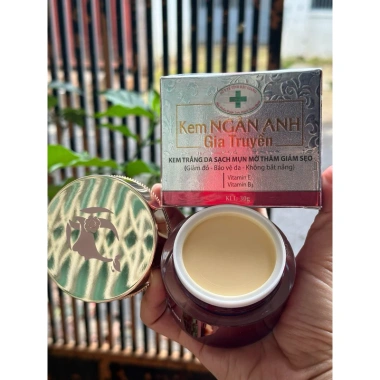 Kem Ngân Anh Trị Mụn Thâm Trắng Da 12/18/30g - Giảm Sẹo, Dưỡng ẩm, Giá 88.000₫