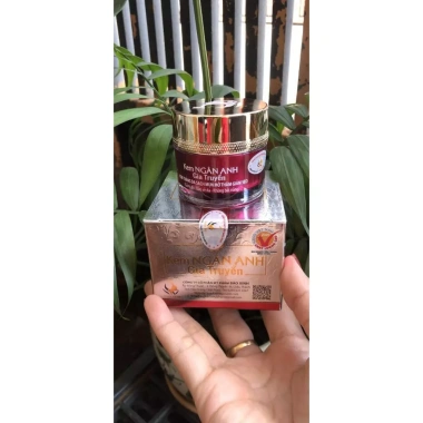 Kem Ngân Anh Trị Mụn Thâm Trắng Da 12/18/30g - Giảm Sẹo, Dưỡng ẩm, Giá 88.000₫