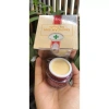 Kem Ngân Anh Trị Mụn Thâm Trắng Da 12/18/30g - Giảm Sẹo, Dưỡng ẩm, Giá 88.000₫ 5