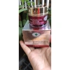 Kem Ngân Anh Trị Mụn Thâm Trắng Da 12/18/30g - Giảm Sẹo, Dưỡng ẩm, Giá 88.000₫ 6