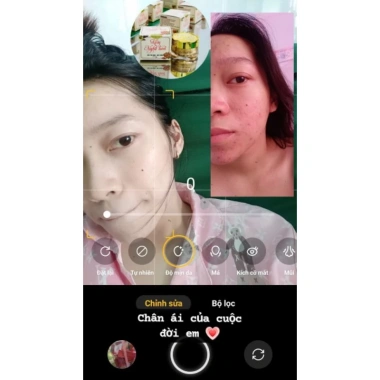 Kem Nghệ Tươi Dưỡng ẩm, Sáng da, Giảm nếp nhăn - Chỉ 120.000 VND 4