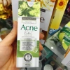 Kem Ngừa Mụn Acne Fast - Giảm Mụn Nhanh, Da Sạch Sáng, Giá Ưu Đãi 84.280 VND 2