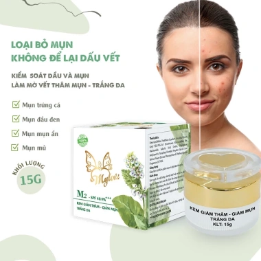 Kem ngừa mụn MyLove trắng da, ngừa vết thâm – Chính hãng Long Phụng Khang 89.000đ