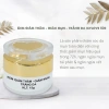 Kem ngừa mụn MyLove trắng da, ngừa vết thâm – Chính hãng Long Phụng Khang 89.000đ 5