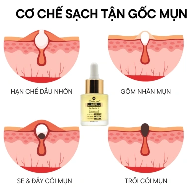Kem ngừa mụn OLY HT 25g - Trắng da, ngừa vết thâm, chính hãng Long Phụng Khang, giảm giá 22% 7