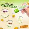 Kem ngừa mụn Yoosun Acnes 15g - Làm sạch bã nhờn, ngừa mụn, giá chỉ 54.000đ 3