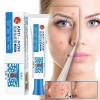 Kem Pha Loãng G6R8 Loại Bỏ Mụn Hiệu Quả, Sửa Chữa Mụn Mặt Giá 41.140 VND 7