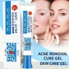 Kem Pha Loãng G6R8 Loại Bỏ Mụn Hiệu Quả, Sửa Chữa Mụn Mặt Giá 41.140 VND 9