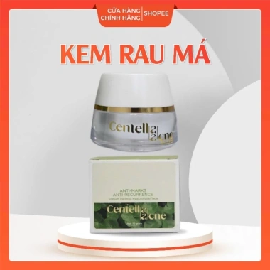 Kem Rau Má Thanh Tô - Dưỡng ẩm, Kiểm soát mụn, Da sáng mịn, Giảm sẹo nhanh