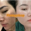 Kem Sâm Nhung Tươi Collagen X10 - Trắng Sáng Da, Giảm Thâm Mụn, Mờ Nám, Da Đều Màu - 189.000đ 4