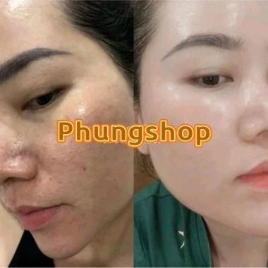 Kem Sâm Nhung Tươi Collagen X10 - Trắng Sáng Da, Giảm Thâm Mụn, Mờ Nám, Da Đều Màu - 189.000đ 4 Kem Sâm Nhung Tươi Collagen X10 - Trắng Sáng Da, Giảm Thâm Mụn, Mờ Nám, Da Đều Màu - 189.000đ 4