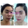 Kem Sâm Nhung Tươi Collagen X10 - Trắng Sáng Da, Giảm Thâm Mụn, Mờ Nám, Da Đều Màu - 189.000đ 5