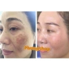 Kem Sâm Nhung Tươi Collagen X10 - Trắng Sáng Da, Giảm Thâm Mụn, Mờ Nám, Da Đều Màu - 189.000đ 6