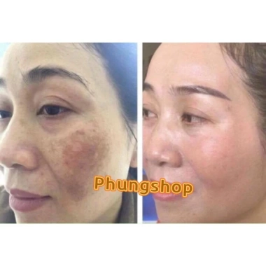 Kem Sâm Nhung Tươi Collagen X10 - Trắng Sáng Da, Giảm Thâm Mụn, Mờ Nám, Da Đều Màu - 189.000đ