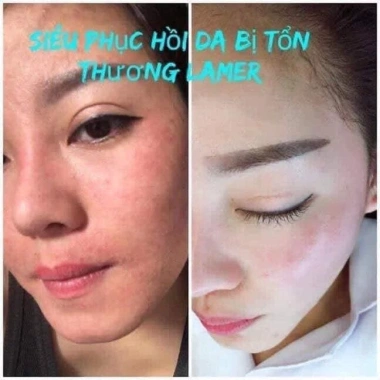 Kem siêu phục hồi Oligo Peptide 99 Ylabcos Dr Lacir - Chính hãng, giá chỉ 375.000₫ 4