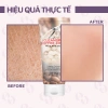 Kem tẩy da chết thải độc Trị Z9 310g - NPP chính hãng, giảm giá 15k, chỉ 50.000đ 9