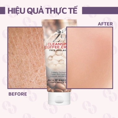 Kem tẩy da chết thải độc Trị Z9 310g - NPP chính hãng, giảm giá 15k, chỉ 50.000đ