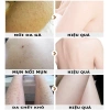 Kem tẩy tế bào chết body 250g - Trắng da, thu nhỏ lỗ chân lông, dưỡng ẩm cấp nước 5