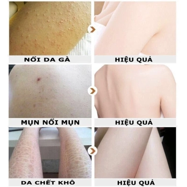 Kem tẩy tế bào chết body 250g - Trắng da, thu nhỏ lỗ chân lông, dưỡng ẩm cấp nước