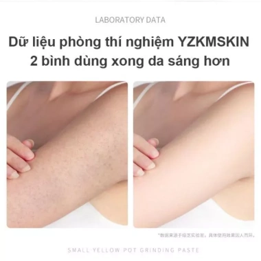 Kem tẩy tế bào chết body 250g - Trắng da, thu nhỏ lỗ chân lông, dưỡng ẩm cấp nước
