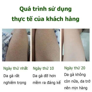 Kem tẩy tế bào chết body 250g - Trắng da, thu nhỏ lỗ chân lông, dưỡng ẩm cấp nước