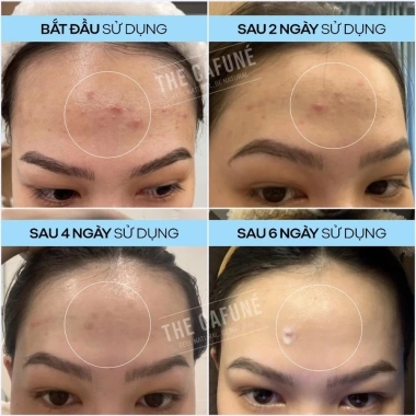 Kem The Cafuné Essence 20g - Dưỡng trắng da tự nhiên, làm dịu mụn, giảm giá 20% - Giá chỉ 150.000đ