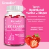 Kẹo dẻo Kenofor Collagen trẻ hóa da, tóc, móng, tăng sức đề kháng - chỉ 174.640 VND 3