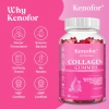 Kẹo dẻo Kenofor Collagen trẻ hóa da, tóc, móng, tăng sức đề kháng - chỉ 174.640 VND 5