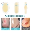 Keo Hydrocoloid Gel Vỉ Thạch Cao Luimo 24 miếng - Chống mòn gót chân, dán SBS 5
