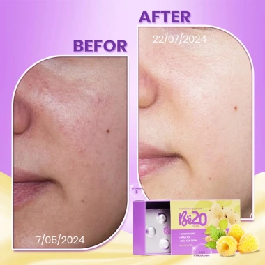 Kẹo ngậm trắng da dâu tằm Be20 3 hộp 30 viên - Da sáng hồng, căng mướt tự nhiên, giảm giá 1.899.000 VND 6