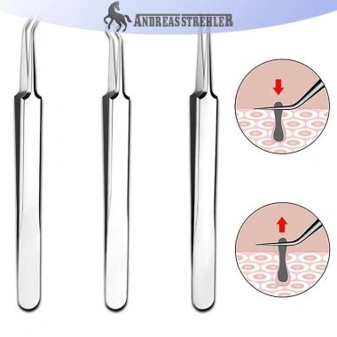 Kẹp Nhíp Mụn Đầu Đen 8CM Onetimingfine - Thẩm mỹ Viện Cạo Đặc Biệt, Giảm Mụn Hiệu Quả, Giá Ưu Đãi 40.428đ