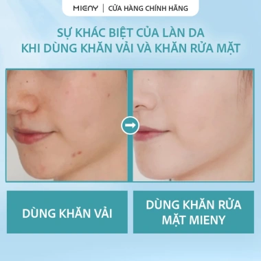 Khăn Cotton Mềm MIENY 1 Lần Lau Khô & Lau Ướt Không Mùi - Rửa mặt, tẩy trang 29.000 VND 3
