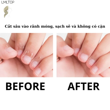 Kìm cắt da tay LMLTOP thép không gỉ H812 – Cắt chính xác, không tổn thương da, 27.685₫