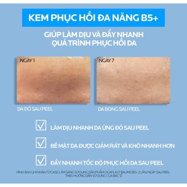 La Roche Posay Cicaplast Baume B5+ - Dưỡng làm dịu giảm kích ứng chỉ 399.000 VND