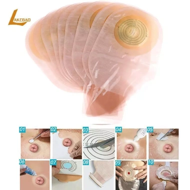 LAKEBAO 10X Túi Ostomy Đơn Lần Hệ Thống Một Mảnh Thoát Nước Bộ Đựng Phân Tử Mới Giá Ưu Đãi 203.500 VND 3