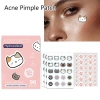 Làm đẹp Miếng Dán Sửa Mụn 96pc 100 Cái Xóa Vết Đỏ Da Mặt Giá 45.430 VND 10