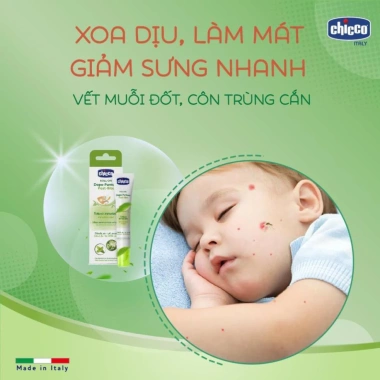 Lăn Bôi Vết Muỗi Đốt Chicco - Giảm Đau, Làm Dịu Nhanh, Giá Ưu Đãi 281.260₫
