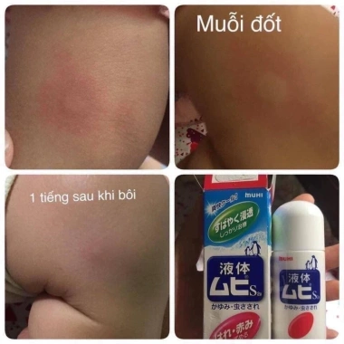 Lăn Muỗi Đốt Muhi Nhật Bản 50ml - Giảm Ngứa, Xua Đuổi Côn Trùng, Giá 180k 8 Lăn Muỗi Đốt Muhi Nhật Bản 50ml - Giảm Ngứa, Xua Đuổi Côn Trùng, Giá 180k 8