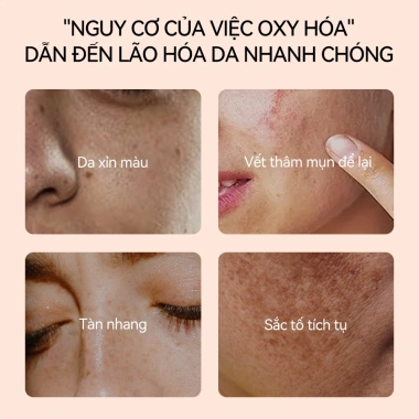 LANBENA Serum Niacinamide 10% + Vitamin C 30ml – Sáng da, mịn, giảm thâm – 339.000 VND 7