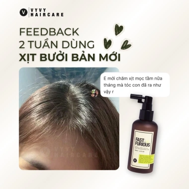 [Link Sỉ] Xịt mọc tóc Redensyl Baicapil Fast & Furious Vyvyhaircare 150ml giảm rụng, tăng mật độ - 220k 4