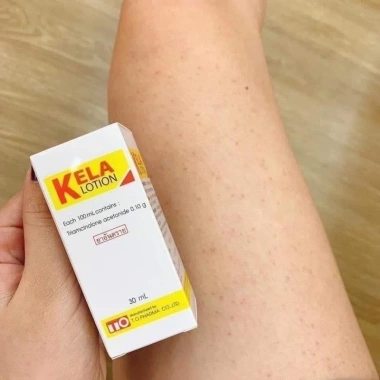 Lotion Kella Giảm Viêm Lỗ Chân Lông và Da Thái Lan - Giá chỉ 239.000đ (Giá gốc 296.360đ)