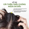 Lotion Kiềm Dầu Happy Hair Day 100ml - Tóc Bồng Bềnh, Giảm Bết, Giá 215.000 VND 5