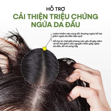 Lotion Kiềm Dầu Happy Hair Day 100ml - Tóc Bồng Bềnh, Giảm Bết, Giá 215.000 VND 5 Lotion Kiềm Dầu Happy Hair Day 100ml - Tóc Bồng Bềnh, Giảm Bết, Giá 215.000 VND 5